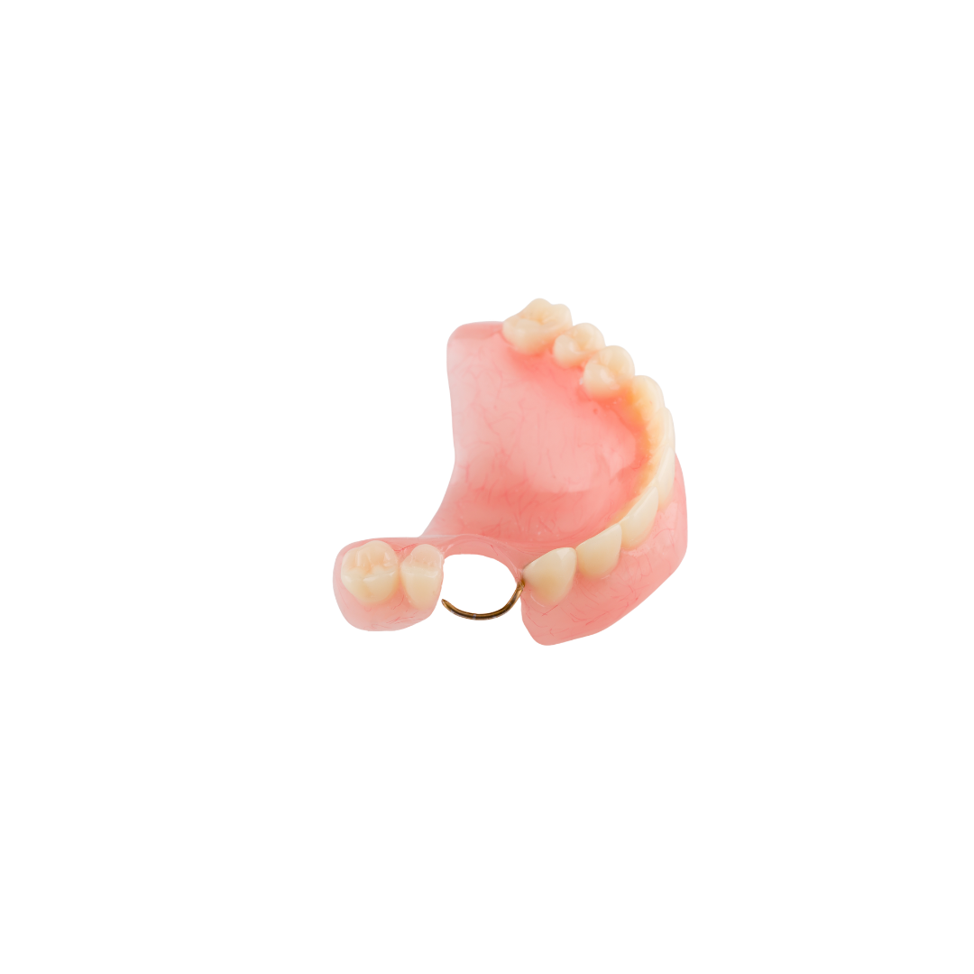 Acrylic partial denture